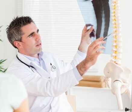 X izpien azterketa batean oinarrituta, medikuak osteokondrosia diagnostikatu ahal izango du.