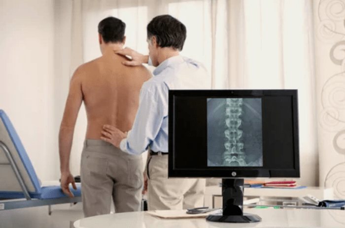 Lumbosacral saileko osteochondrosis
